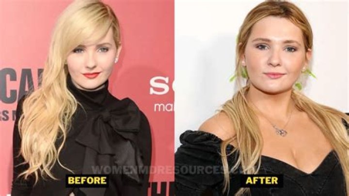 Accused Cast Abigail Breslin Weight Loss Journey: Before And After