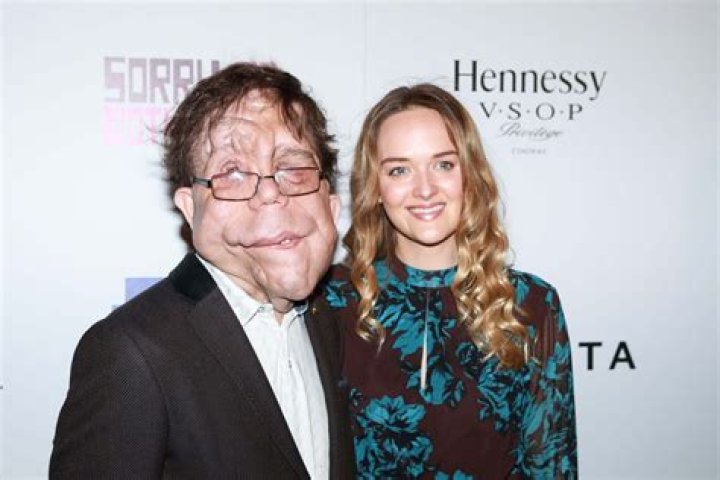 Adam Pearson’s Wife – Is He In A Relationship With Anyone?