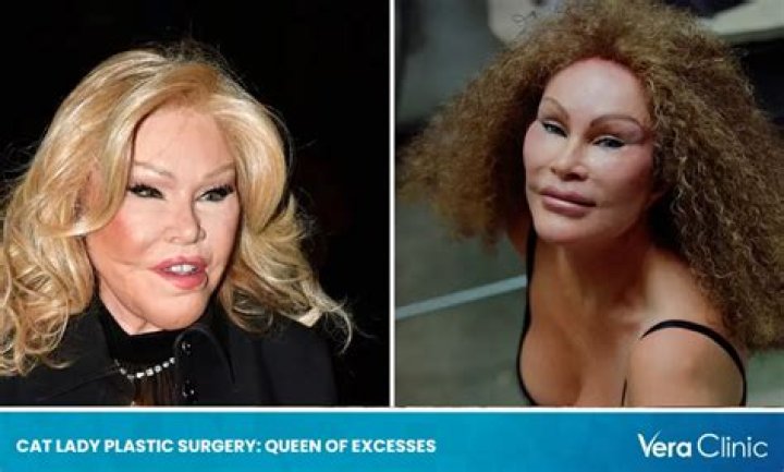 
Cat Woman Plastic Surgery: Flashback to Her Youth-A Glance at Her Childhood Beauty! 