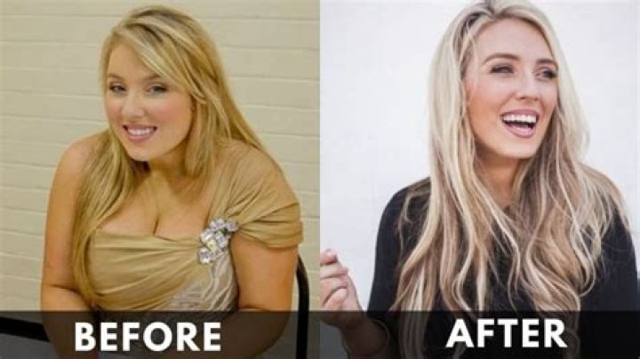 Chloe Agnew Underwent An Exceptional Weight Loss Transformation