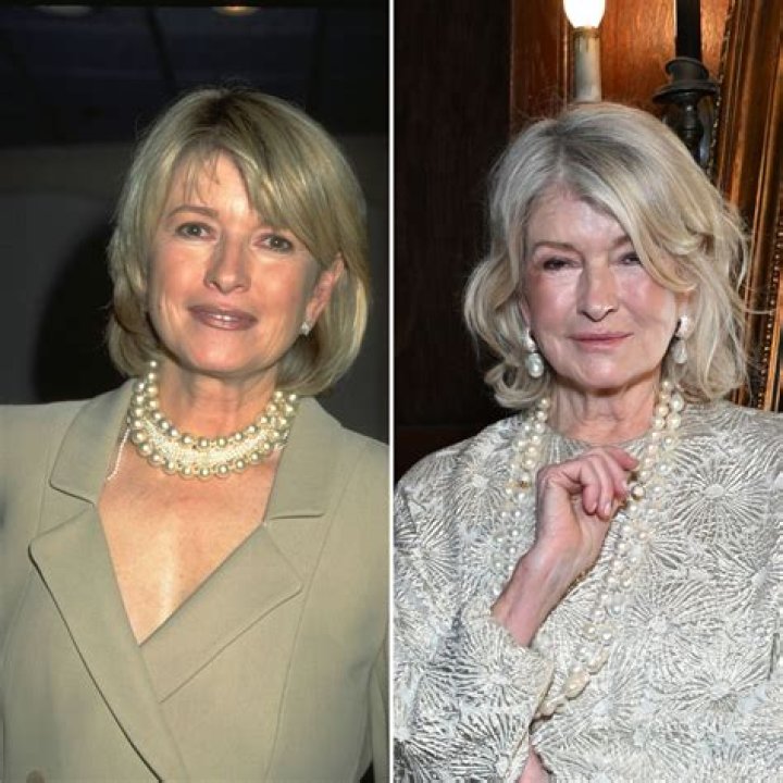 Did Martha Stewart Get A Facelift Surgery? Before And After Photos