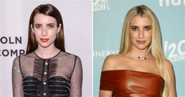 Has Emma Roberts Done Plastic Surgery? Fans Are Curious If She Had Lip Filler And Botox