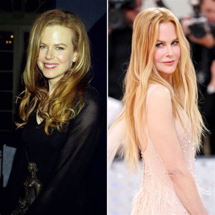Nicole Kidman Facelift | Plastic Surgery Before And After