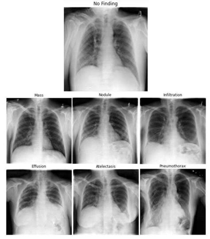 Rolling Ray Condition: Is Rolling Ray paralyzed? Is Rolling Ray OK?