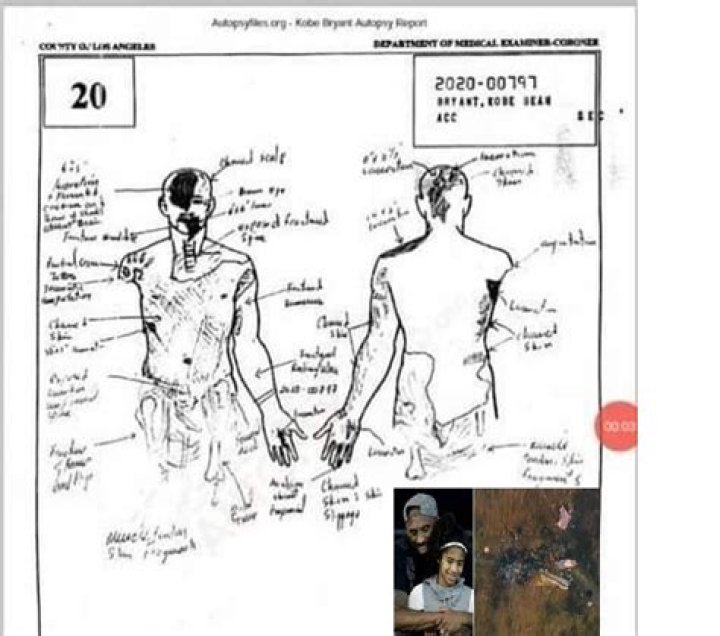 
This Is Why Kobe Bryant Autopsy Sketch Should Not Have Been On Reddit 