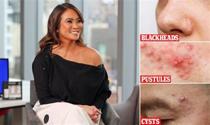 
What Happened To Kevin Olaeta That Was On Dr Pimple Popper? Obituary California Update 